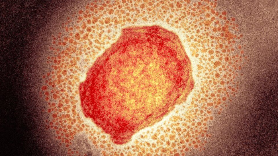 This image has an empty alt attribute; its file name is 103598601_m0501256-monkeypox_virus_particle_tem-spl.jpg